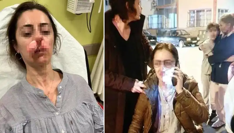 Eşinin Sevgilisi Sandığı Adamı Otomobil Kapısıyla Vurdu: Olayın Perde Arkası