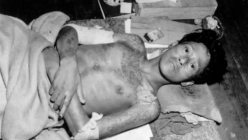 80 Yıl Sonra Nagasaki'den Gelen Uyarı: Nükleer Felaket Tehdidi Büyüyor