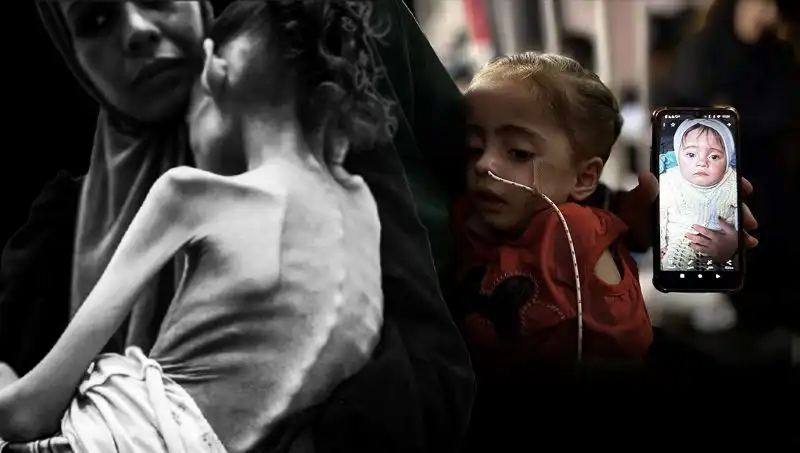 Küçük Meryem’in Aşırı Zayıflığı: Sıfır Kalori ile Yaşam Mücadelesi