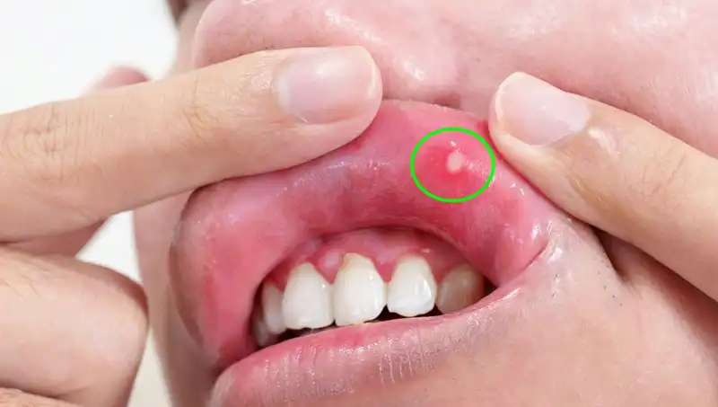 Vücudunuza Hayati Önemi Olacak 5 B Vitamini Eksikliği Belirtisi